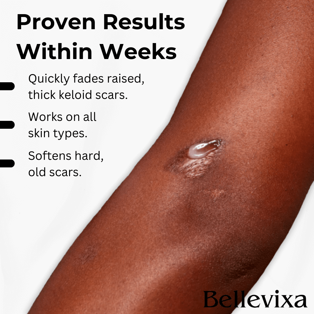 Bellevixa™ Scar Removal Gel