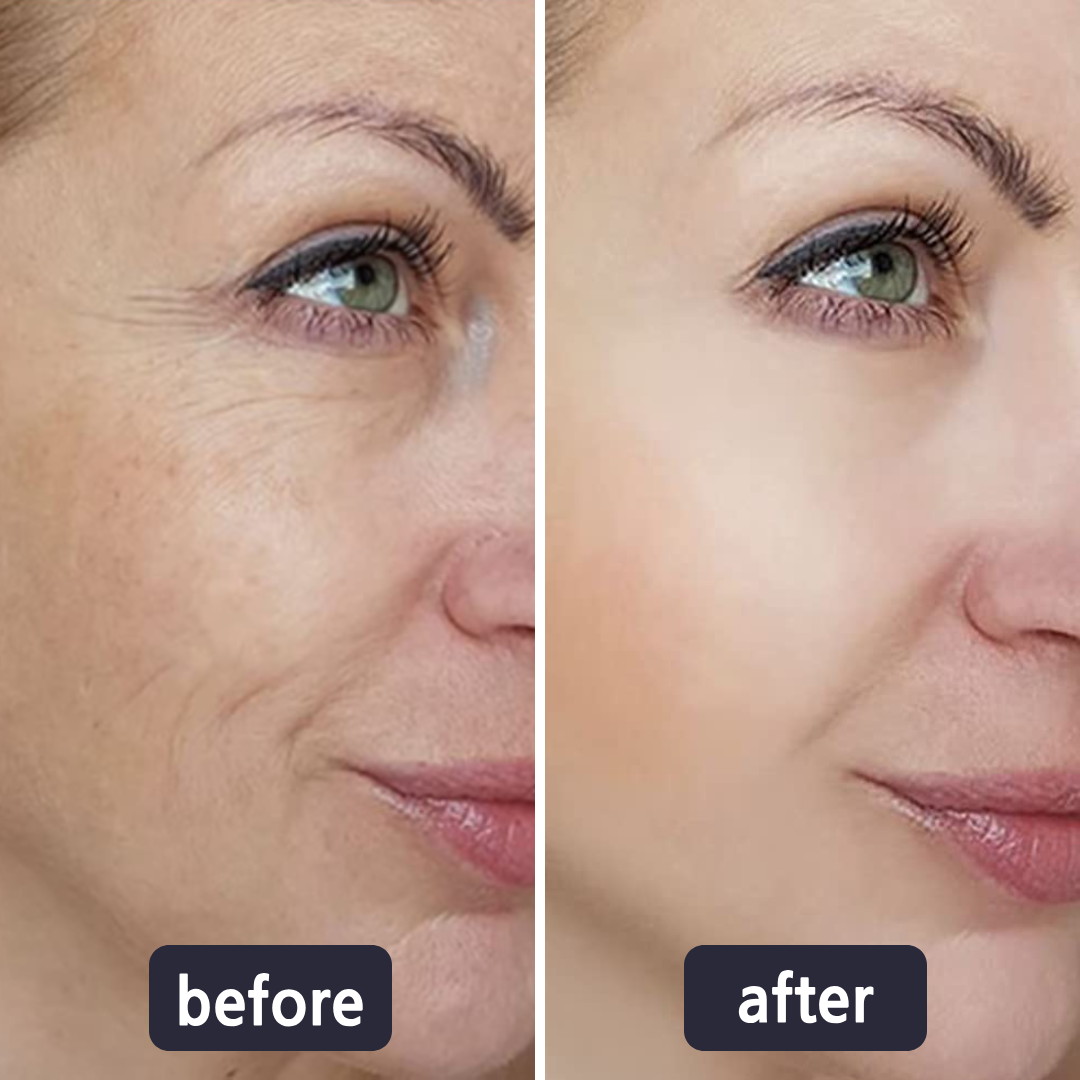 Bellevixa™ 4-in-1 Skincare Wand